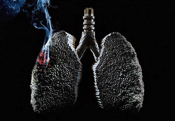 Cancer de pulmón