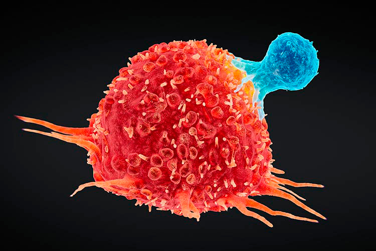 Cáncer