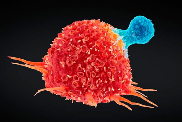 10 curiosidades sobre el Cáncer